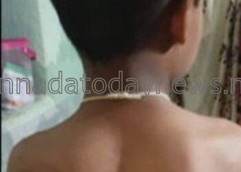 ಎರಡನೇ ತರಗತಿಯ ವಿದ್ಯಾರ್ಥಿಯೋರ್ವನಿಗೆ ಕೋಲಿನಿಂದ ಬಾಸುಂಡೆ ಬರುವಂತೆ ಹೊಡೆದ ಶಿಕ್ಷಕ