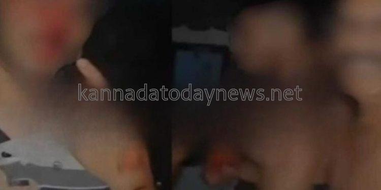 ಒಂದು ಹುಡುಗಿ ವಿಚಾರದಲ್ಲಿ ಮೈಯಲ್ಲಿ ರಕ್ತ ಬರುವ ಹಾಗೆ ಬಡಿದಾಡಿಕೊಂಡ ಮಂಗಳೂರಿನ ಕಾಲೇಜು ಯುವಕರು
