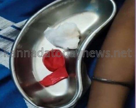 ಸರ್ಕಾರಿ ಪ್ರಾಥಮಿಕ ಶಾಲೆಯ 7ನೇ ತರಗತಿ ವಿದ್ಯಾರ್ಥಿ ನವೀನ ಬಲೂನ್ ಊದುವಾಗ ಗಂಟಲಲ್ಲಿ ಬಲೂನ್ ಸಿಲುಕಿ ಉಸಿರುಗಟ್ಟಿ ಸಾವು