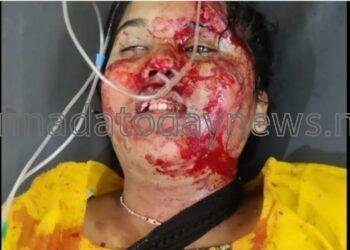 ಸಿದ್ದಾಪುರ ಅಯ್ಯಪ್ಪ ಸ್ವಾಮಿ ಜಾತ್ರಾ ಮಹೋತ್ಸವ – ಭಕ್ತರ ಮೇಲೆ ಹರಿದ ಕಾರು – ಓರ್ವ ಯುವತಿ ಸಾವು 08 ಭಕ್ತರಿಗೆ ಗಂಭೀರ ಗಾಯ – ಕಾರು ಚಾಲಕ ಬಂಧಿಸಿದ ಸಿದ್ದಾಪುರ ಪೊಲೀಸರು*