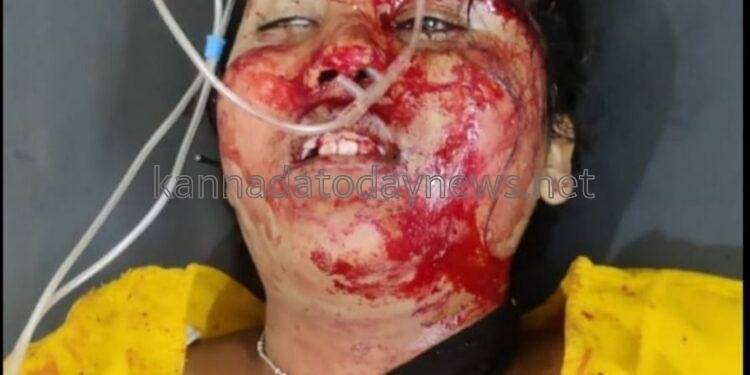 ಸಿದ್ದಾಪುರ ಅಯ್ಯಪ್ಪ ಸ್ವಾಮಿ ಜಾತ್ರಾ ಮಹೋತ್ಸವ – ಭಕ್ತರ ಮೇಲೆ ಹರಿದ ಕಾರು – ಓರ್ವ ಯುವತಿ ಸಾವು 08 ಭಕ್ತರಿಗೆ ಗಂಭೀರ ಗಾಯ – ಕಾರು ಚಾಲಕ ಬಂಧಿಸಿದ ಸಿದ್ದಾಪುರ ಪೊಲೀಸರು*