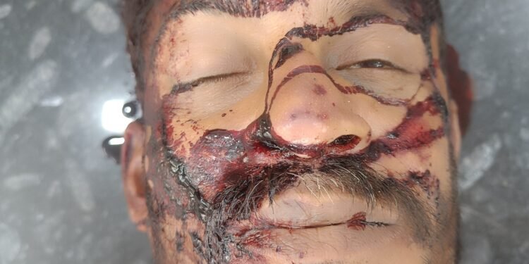 ಭಟ್ಕಳದಲ್ಲಿ ಭೀಕರ ರಸ್ತೆ ಅಪಘಾತ: ಬೈಕ್ ನಿಯಂತ್ರಣ ತಪ್ಪಿ ವ್ಯಕ್ತಿ ಸ್ಥಳದಲ್ಲೇ ಸಾವು:ಮುರುಡೇಶ್ವರದಿಂದ ಬೈಲೂರು ಕಡೆಗೆ ಪ್ರಯಾಣದ ವೇಳೆ ದುರಂತ