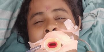 ಭಟ್ಕಳದ ಸಂಶನೂರು ಆಸ್ಪತ್ರೆಯಲ್ಲಿ ಹೊಟ್ಟೆ ನೋವಿಗೆ ಚಿಕಿತ್ಸೆ ಪಡೆದ ಮುರುಡೇಶ್ವರ ಸಮೀಪದ ಮಹಿಳೆ ಅನುಮಾನಾಸ್ಪದ ಸಾವು